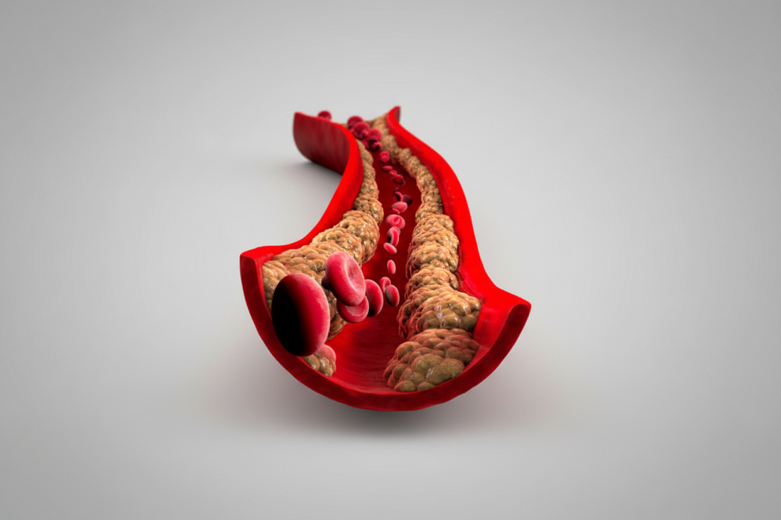 Kaip stebėti cholesterolio lygį: svarbūs patarimai sveikatai