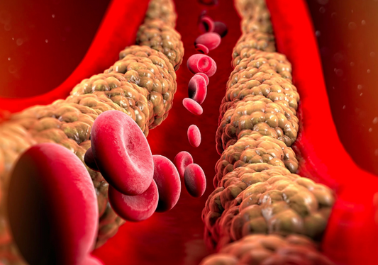 Kaip stebėti cholesterolio lygį: svarbūs patarimai sveikatai